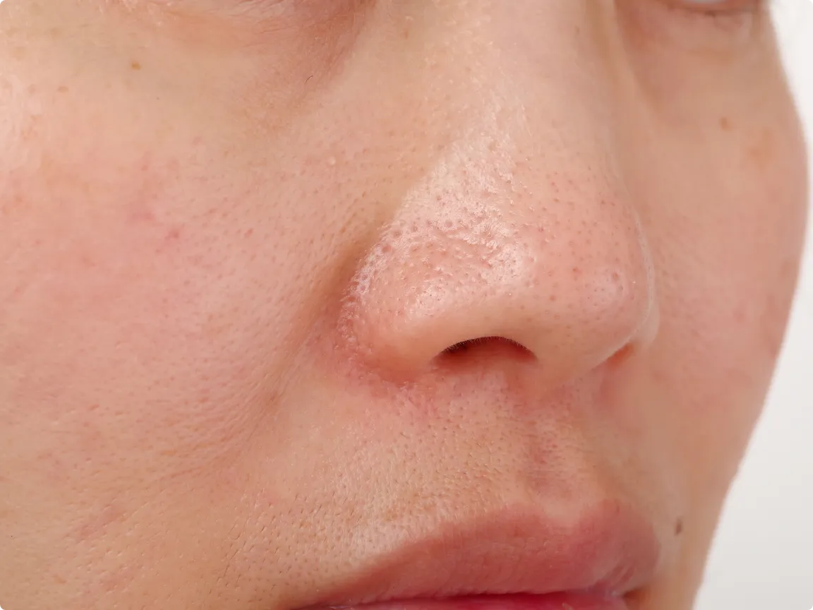 ポテンツァマックームのイメージ画像