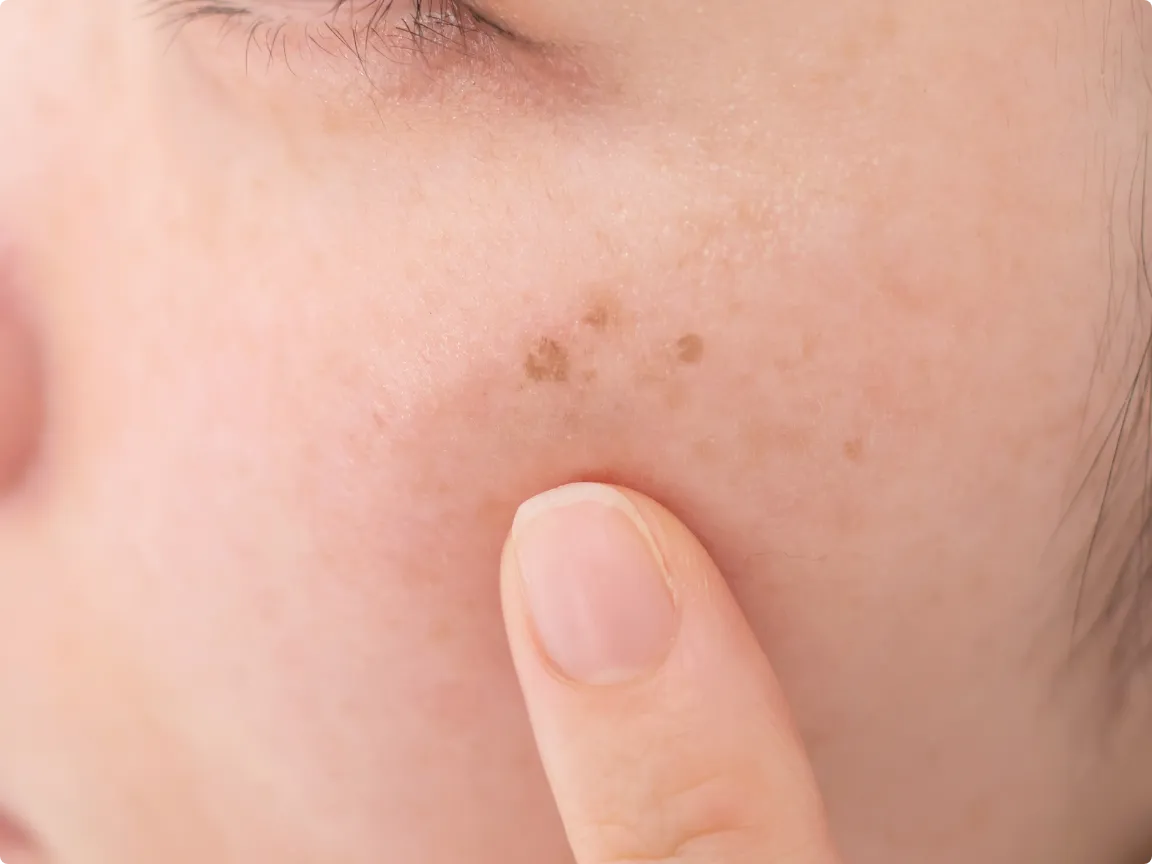 ポテンツァマックームのイメージ画像