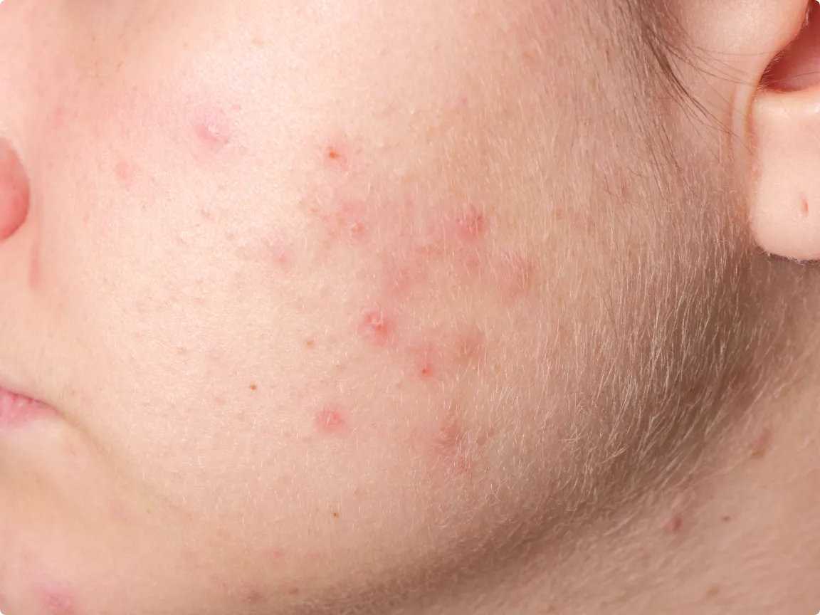 ポテンツァマックームのイメージ画像